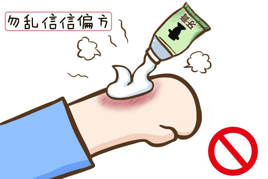 儿童烧烫伤如何紧急处理